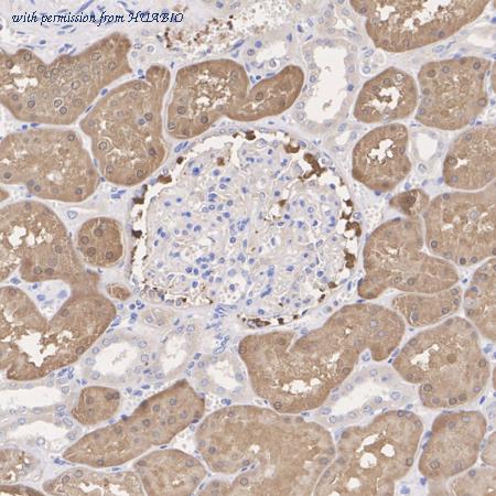 HUABIO ER1803-75 image 2