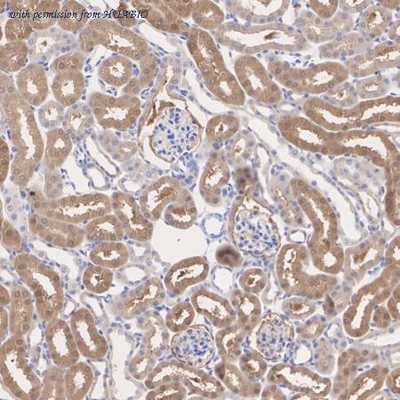 HUABIO ER1803-75 image 3