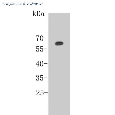 HUABIO ER1803-83 image 1