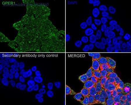HUABIO ER1803-90 image 2