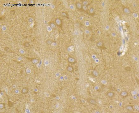 HUABIO ER1803-92 image 3