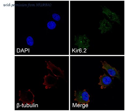 HUABIO ER1803-98 image 2