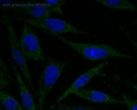 HUABIO ER1804-01 image 3