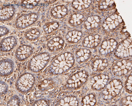 HUABIO ER1804-02 image 2