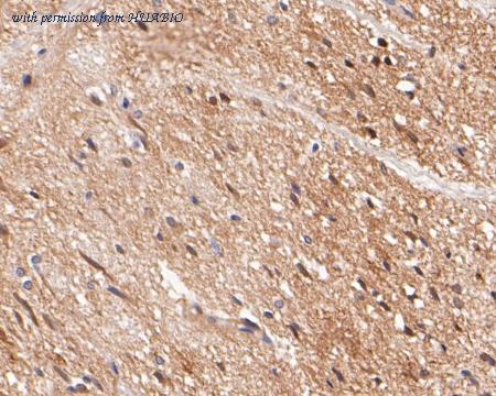 HUABIO ER1901-23 image 2