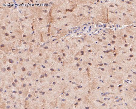 HUABIO ER1901-23 image 3