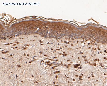 HUABIO ER1901-36 image 3