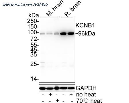 HUABIO ER1901-41 image 1