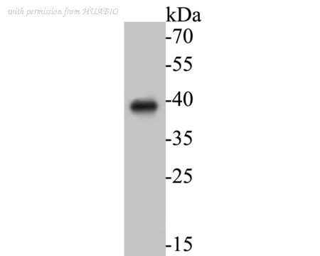 HUABIO ER1901-51 image 1