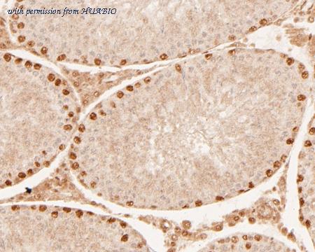 HUABIO ER1901-52 image 3