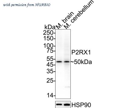 HUABIO ER1901-53 image 1
