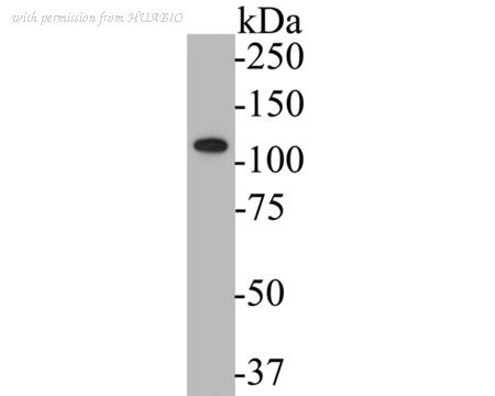 HUABIO ER1901-55 image 1