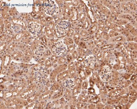 HUABIO ER1901-64 image 3