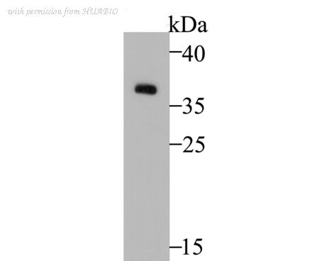 HUABIO ER1901-65 image 1