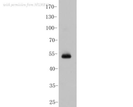HUABIO ER1901-67 image 1