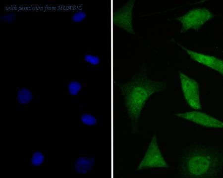 HUABIO ER1901-73 image 2