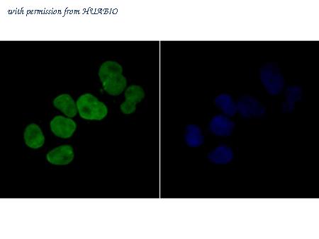 HUABIO ER1901-75 image 2