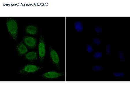 HUABIO ER1901-75 image 3