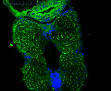 HUABIO ER1901-77 image 1