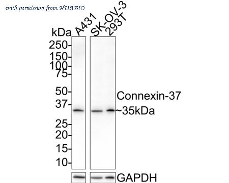 HUABIO ER1901-85 image 1