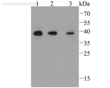 HUABIO ER1901-91 image 1