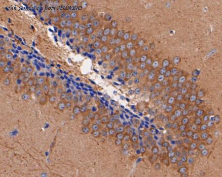 HUABIO ER1901-99 image 3