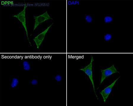 HUABIO ER1902-07 image 3