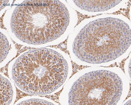 HUABIO ER1902-13 image 2