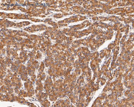 HUABIO ER1902-13 image 3