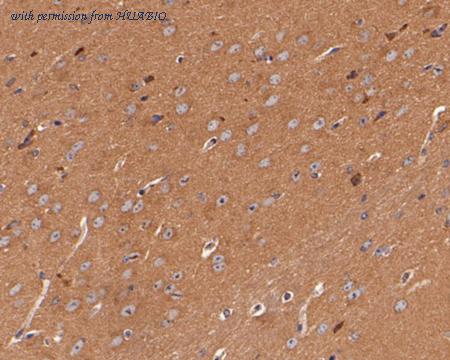 HUABIO ER1902-57 image 3