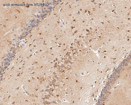 HUABIO ER1902-59 image 2