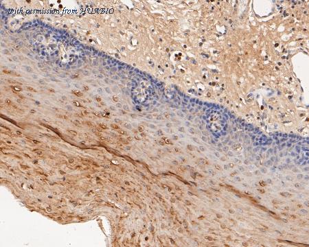 HUABIO ER1902-59 image 3