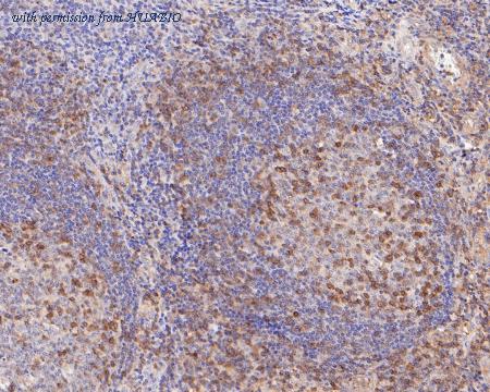 HUABIO ER1902-77 image 2