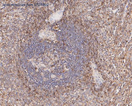 HUABIO ER1902-77 image 3