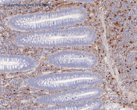 HUABIO ER1902-79 image 2