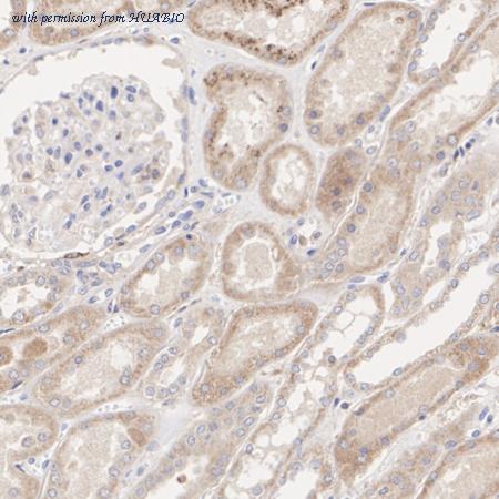 HUABIO ER1902-80 image 3