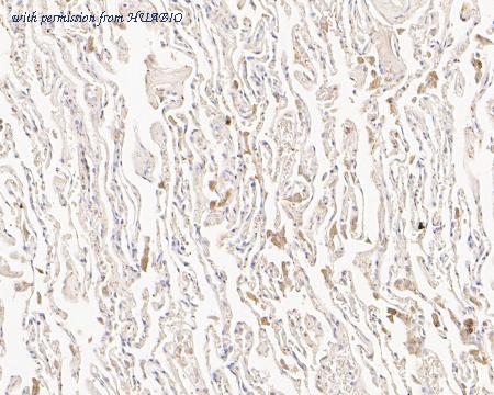 HUABIO ER1902-84 image 2