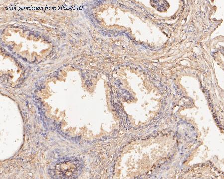 HUABIO ER1902-84 image 3