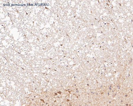 HUABIO ER1902-88 image 2