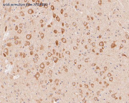 HUABIO ER1902-88 image 3