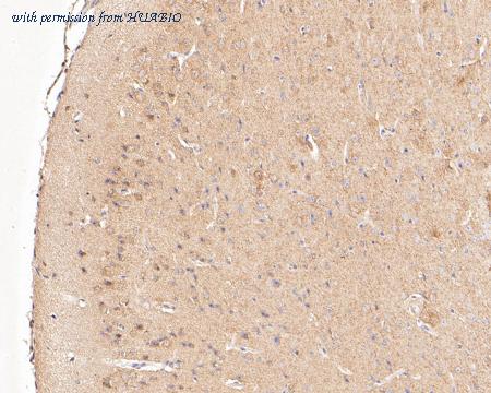 HUABIO ER1902-94 image 3