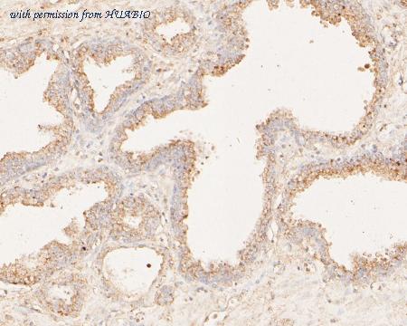 HUABIO ER1902-99 image 2