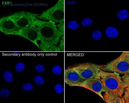 HUABIO ER1909-14 image 2