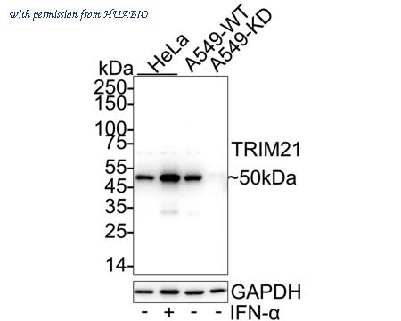 HUABIO ER1918-07 image 1
