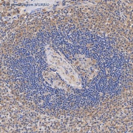 HUABIO ER1918-07 image 3