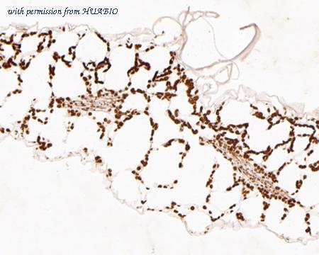 HUABIO ER2001-03 image 2