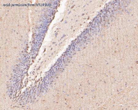 HUABIO ER2001-11 image 2