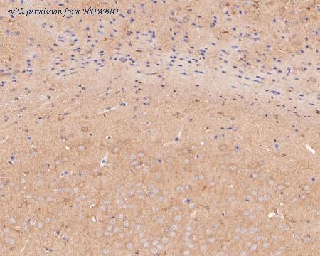 HUABIO ER2001-11 image 3