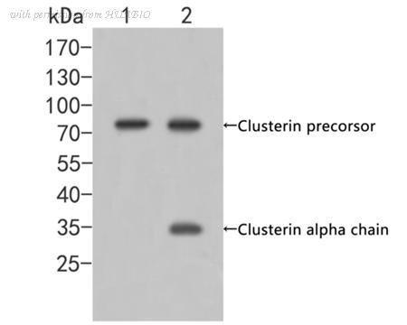 HUABIO ER2001-58 image 1