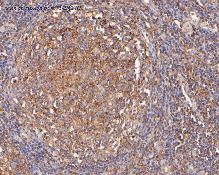 HUABIO ER2001-58 image 2